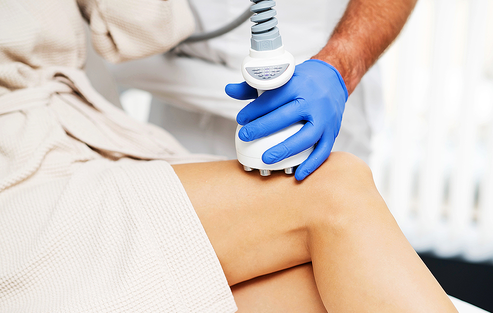 Popust 20 % na radiofrekvenciju lica i tijela