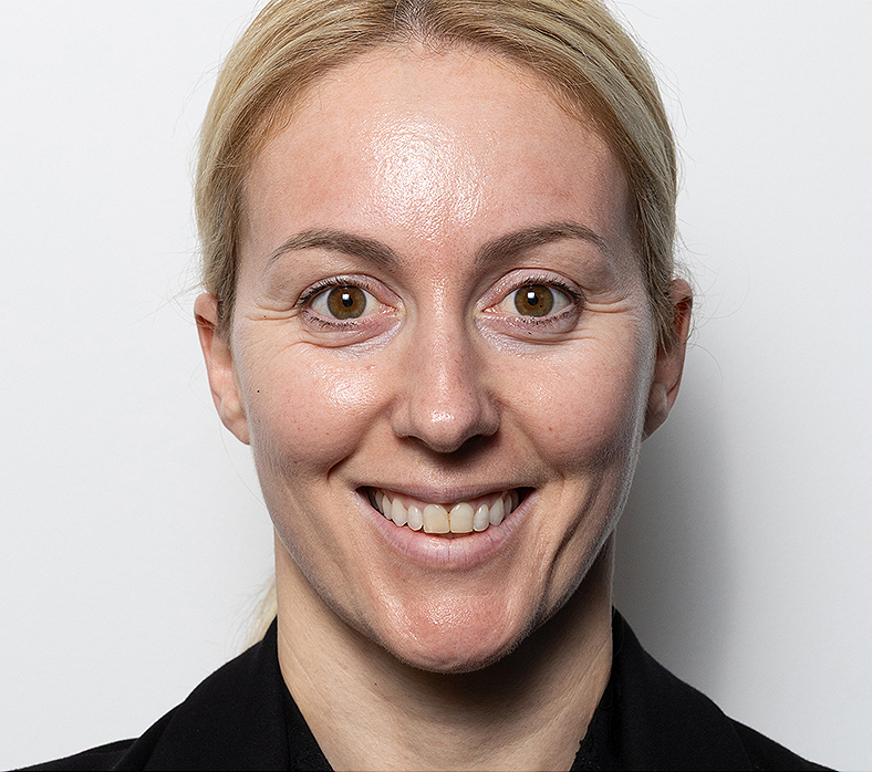 Injekcije za bore, Botox, sl. 1 - prije