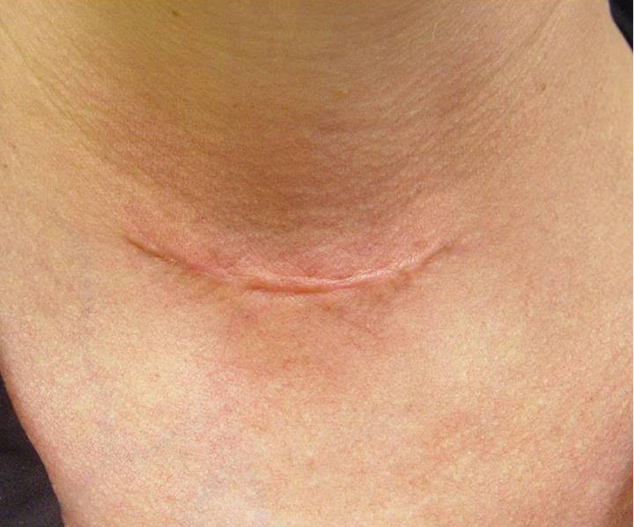 Laser Genesis - prije 3