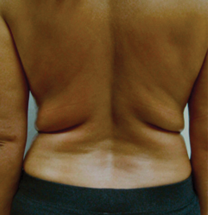 Body Shape - poslije 3