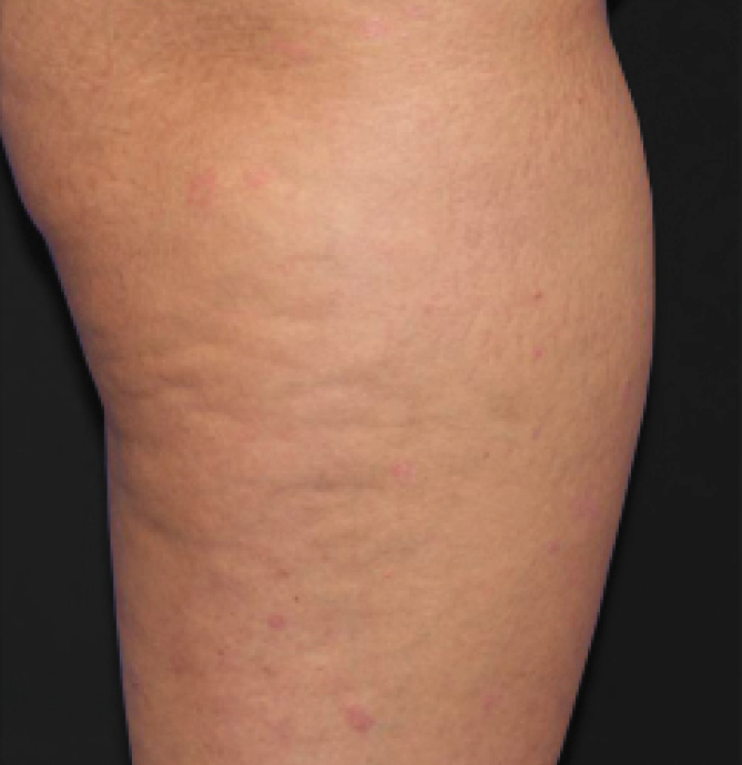 Body Shape - prije 2