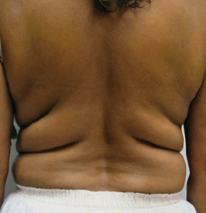 Body Shape - prije 3