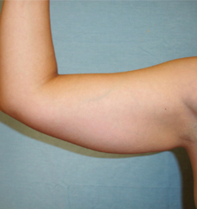 Body Shape and Tight - prije 1