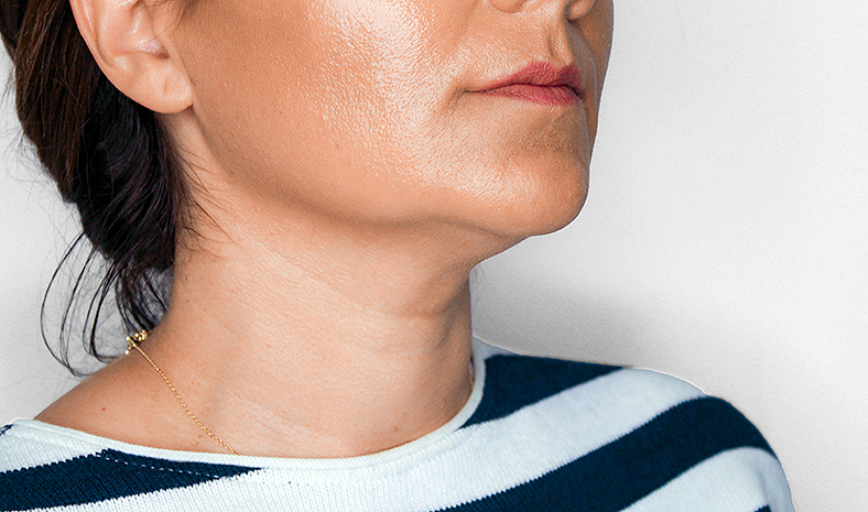 PB Serum, podbradak, sl. 3 - poslije