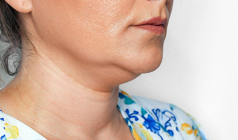 PB Serum, podbradak, sl. 3 - prije