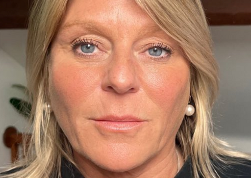 Sunekos biostimulator - Poslije sl.1