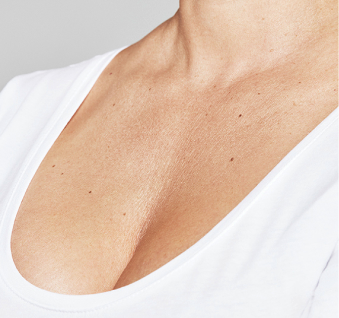 Pomlađivanje ruku, vrata i dekoltea - prije 1